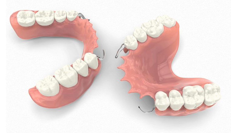 Dental Dentures, Partial Dentures in Ludhiana India